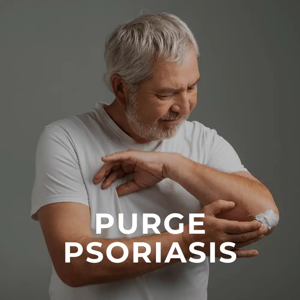 A man can Bragan`s elbow cream with the inscription "Purge Psoriasis"