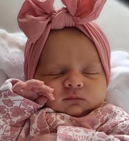 photograph of infant acne after