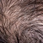 shampoo for thinning hair,