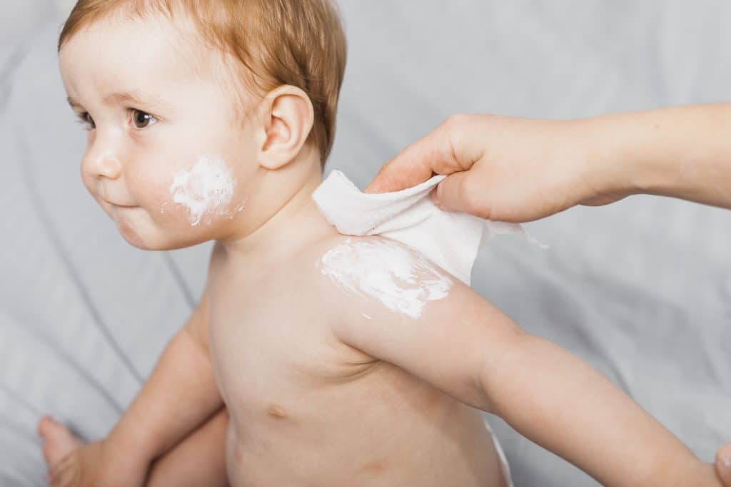 dermatitis in infants, infant eczema cream