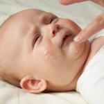 cream for atopic dermatitis,