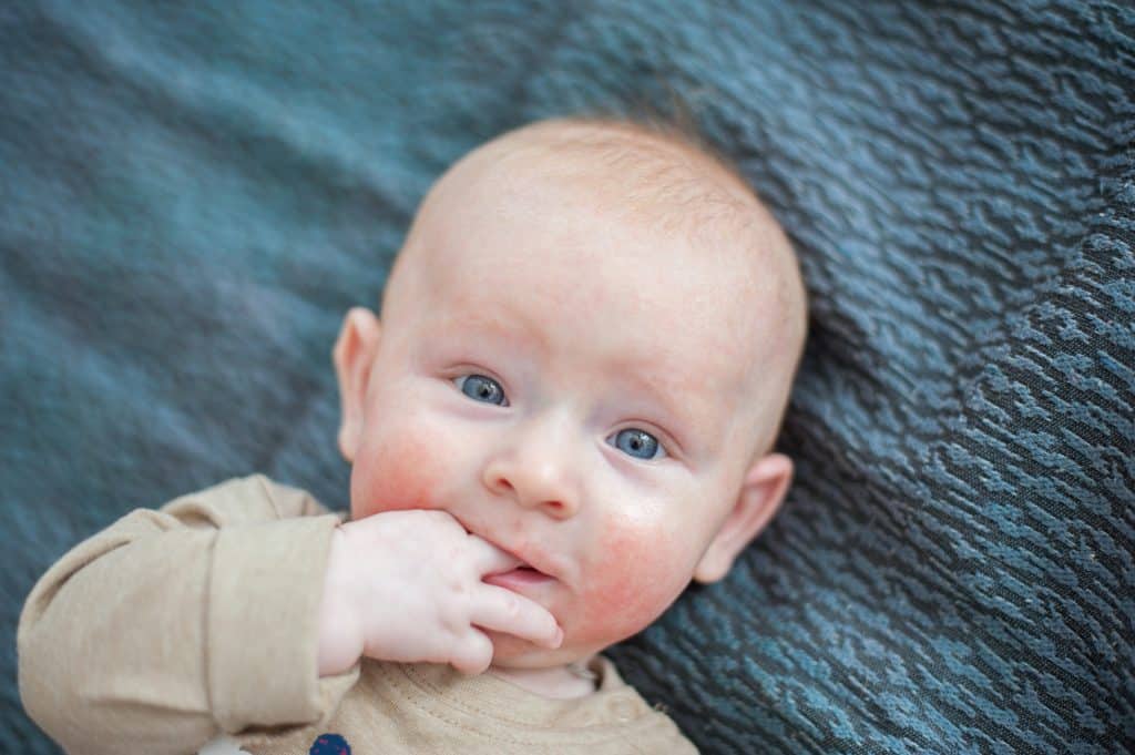 fragrance-free baby cream for atopic dermatitis