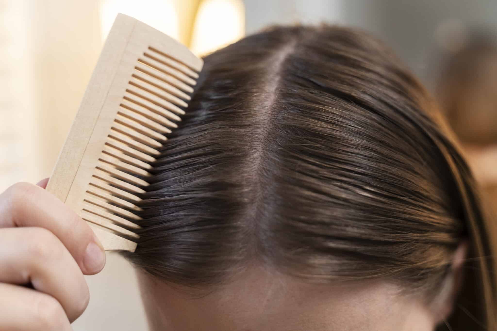 photo of scalp parting after seborrheic treatment