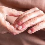 Hands with eczema applying fragrance-free moisturiser