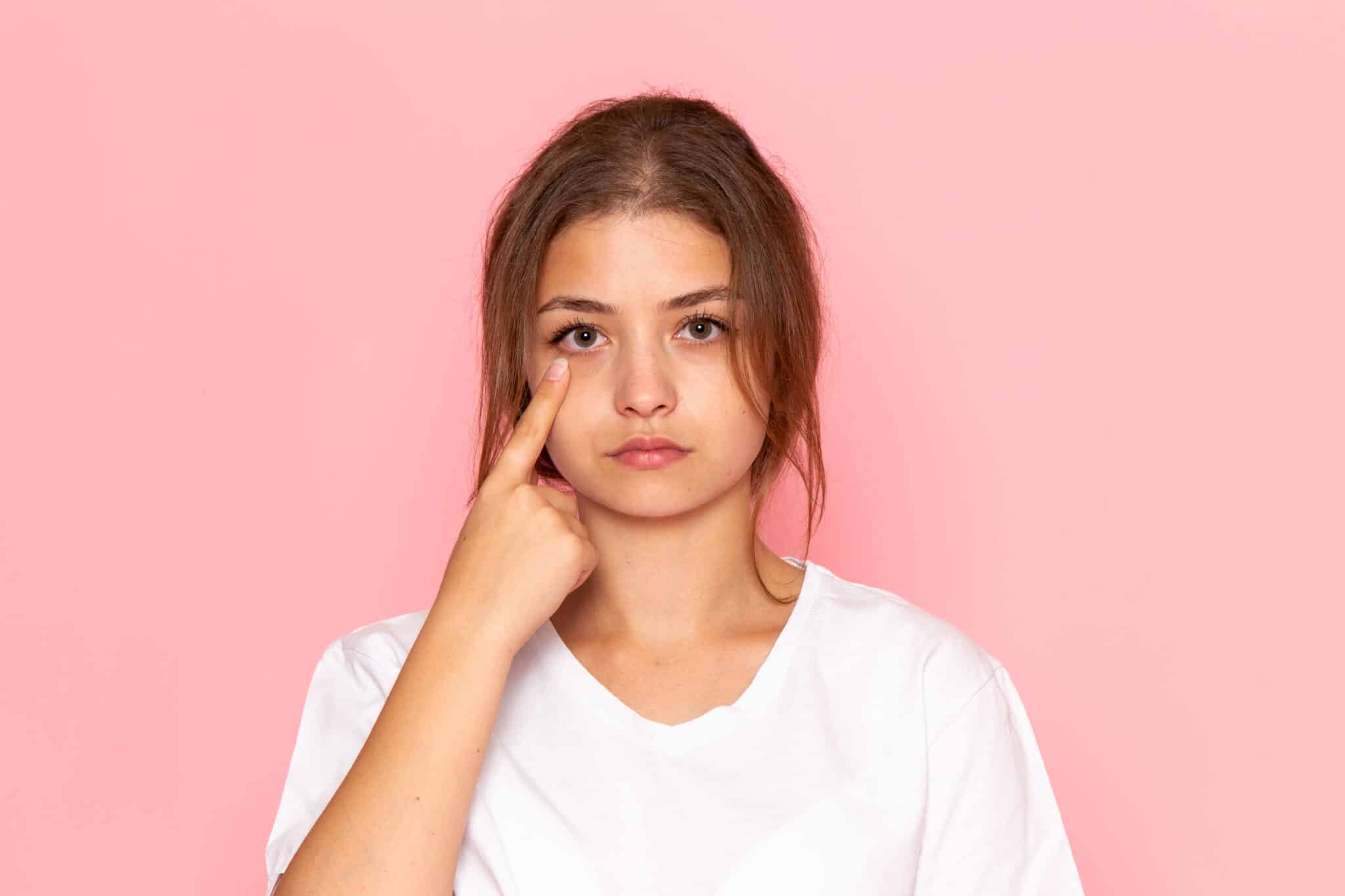 eczema on eyelids (eyelid eczema) causing redness and irritation