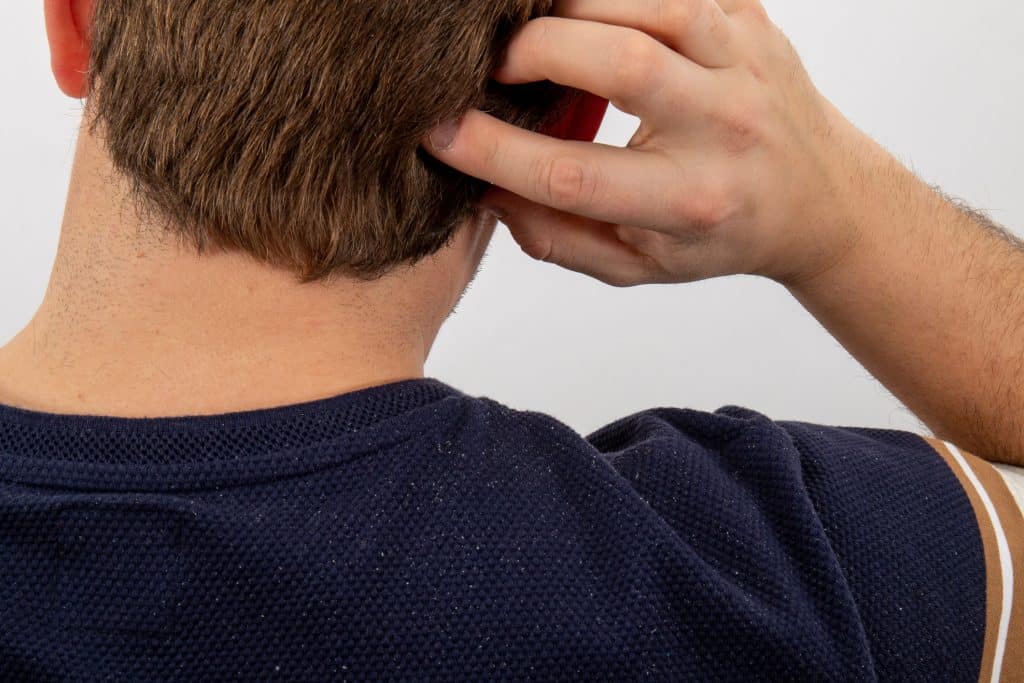 Natural scalp treatment with soothing ingredients
