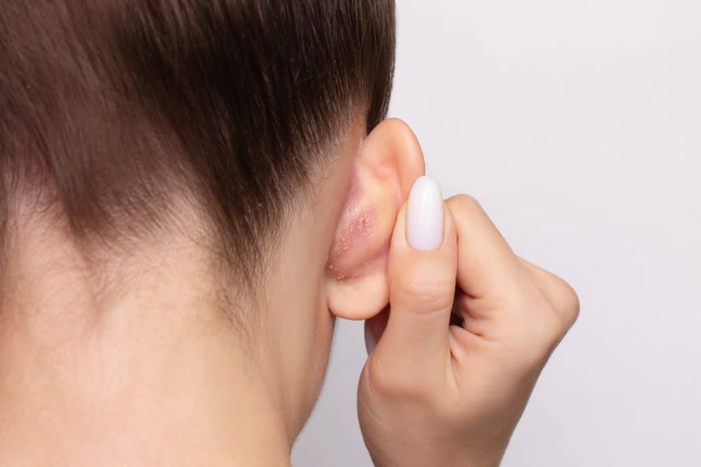 Person scratching behind ear (stock photo)