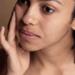 how to treat sensitive, fragrance free, ​sebhorrheic dermatitis treatment, scalp care, antifungal shampoos, moisturizing creams, skin care routines, natural remedies,seborrheic dermatitis , Perioral dermatitis on dark skin