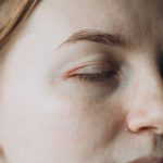 lady with a dry eye lid