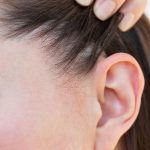 ​Dry Scalp vs Itchy Scalp