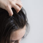 best shampoo for seboorheic dermatitis