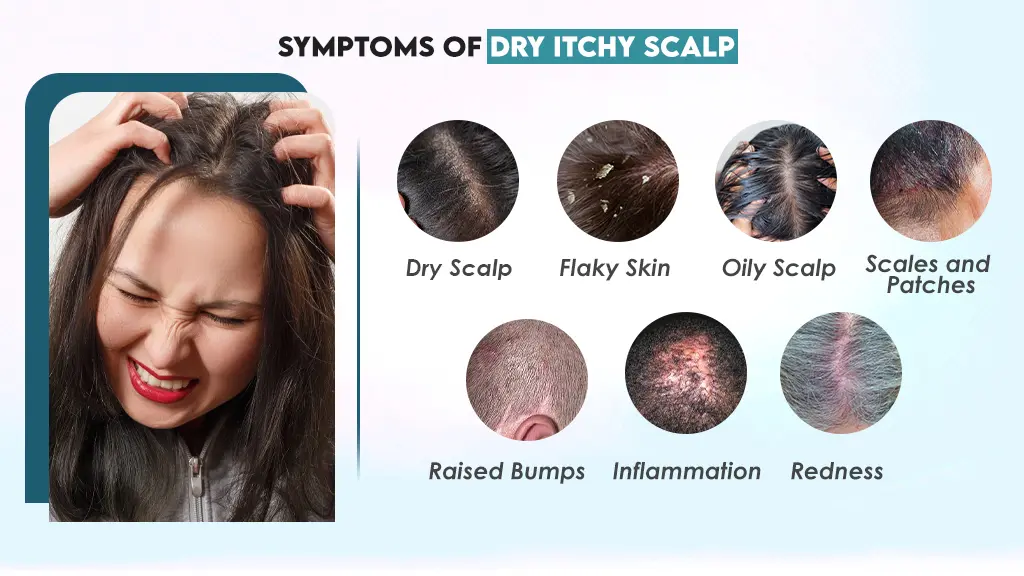 symptoms of an itchy graphic
