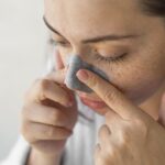 Seborrheic Dermatitis Around the Nose Treatment