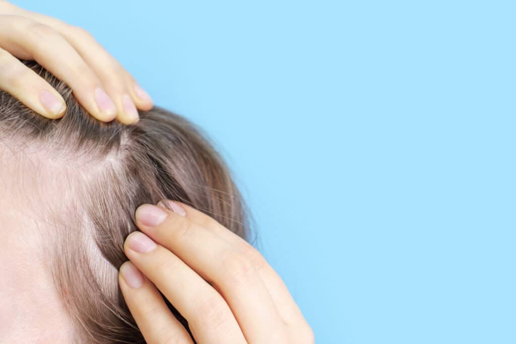girl examining her dry scalp